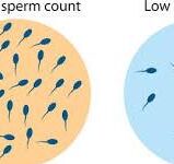 Vitamin E deficiency symptom - low sperm count