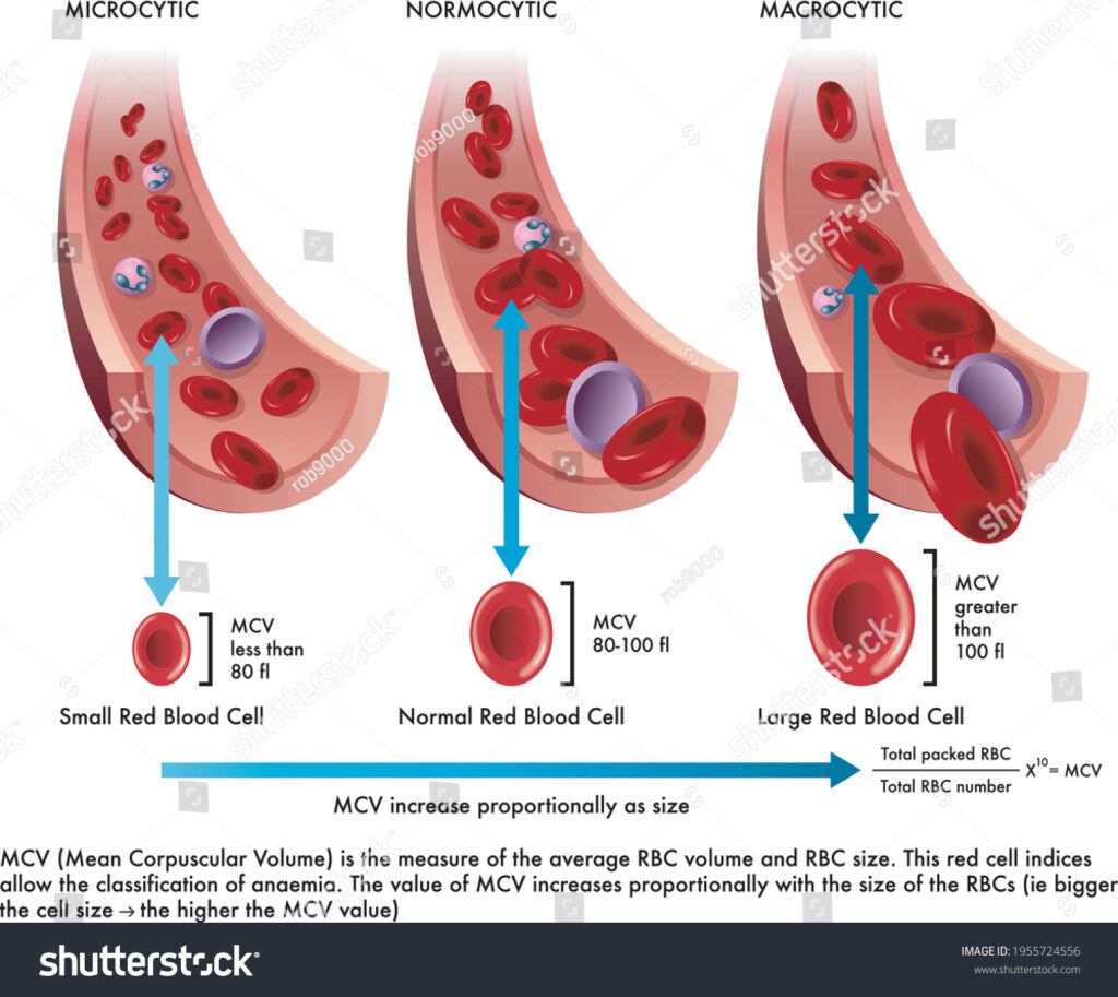 riboflavin deficiency symptom